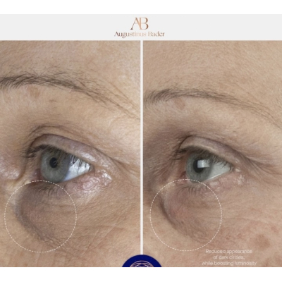 Крем для кожи вокруг глаз Augustinus Bader The Eye Cream 3 ml