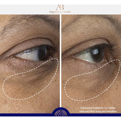 Крем для кожи вокруг глаз Augustinus Bader The Eye Cream 3 ml