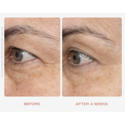 Крем для шкіри навколо очей з ретинолом First Aid Beauty Retinol Eye Cream with Squalane + Ceramides 15 ml