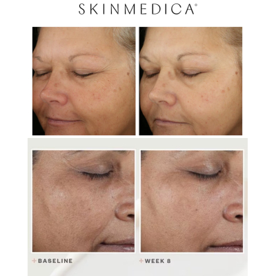 Набор сывороток для омоложения кожи лица Skinmedica Lumivive Day & Night System 2x7.1 g Travel Size