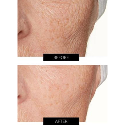 Антивозрастное увлажняющее масло для лица с ферментами Lancer Omega Hydrating Oil with Ferment Complex 4.5 ml