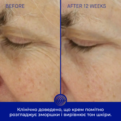 Омолаживающий крем для лица Augustinus Bader The Light Cream with TFC8 (30 ml)