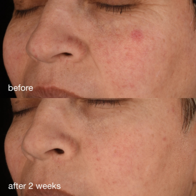 Антиоксидантна сироватка з колагеном Dermalogica Pro-Collagen Banking Serum 5 ml