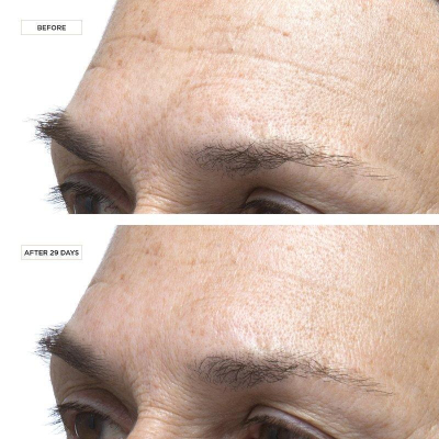 Антивіковий інтенсивно зволожуючий комплекс Perricone MD Cold Plasma Plus+ The Intensive Hydrating Complex 7.5 ml