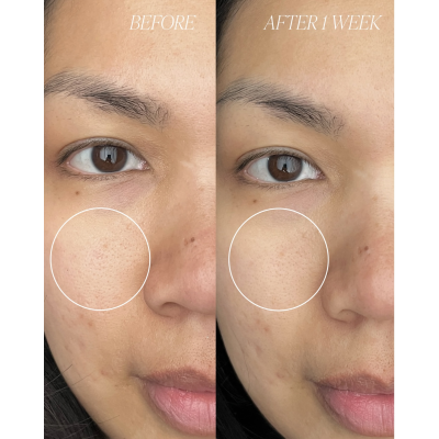 Очищуюча маска для обличчя Byroe Peach Kombucha Tea Purifying Clay Mask 80 g