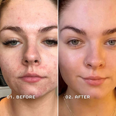 Сироватка для вирівнювання тону та текстури шкіри обличчя REN Clean Skincare Glow And Protect Serum 30 ml