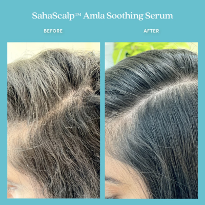 Олія-сироватка для шкіри голови Fable & Mane SahaScalp Amla Soothing Serum 55 ml